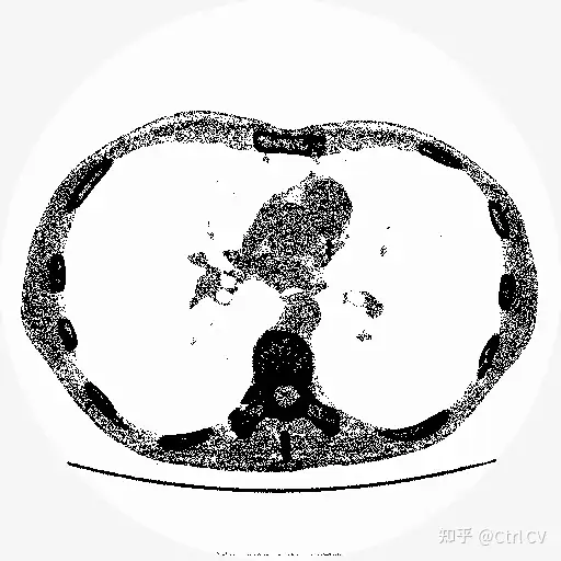 YOLOv8医学图像分割