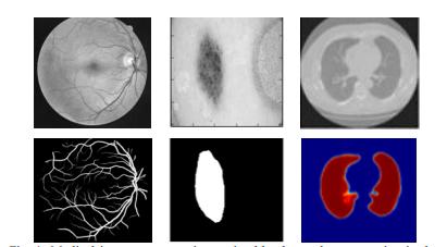 图1。医学图像分割：左侧为视网膜血管分割，右侧为皮肤癌病灶分割，右侧为肺部分割。