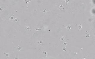 【微观世界016期】细菌污染下的HeLa细胞培养4天纪实CytoSMART Lux2 成像仪