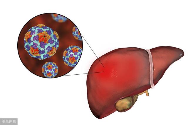 pvt检查是什么意思丙肝三低三高是什么想揪出丙肝这些检查项目必不可