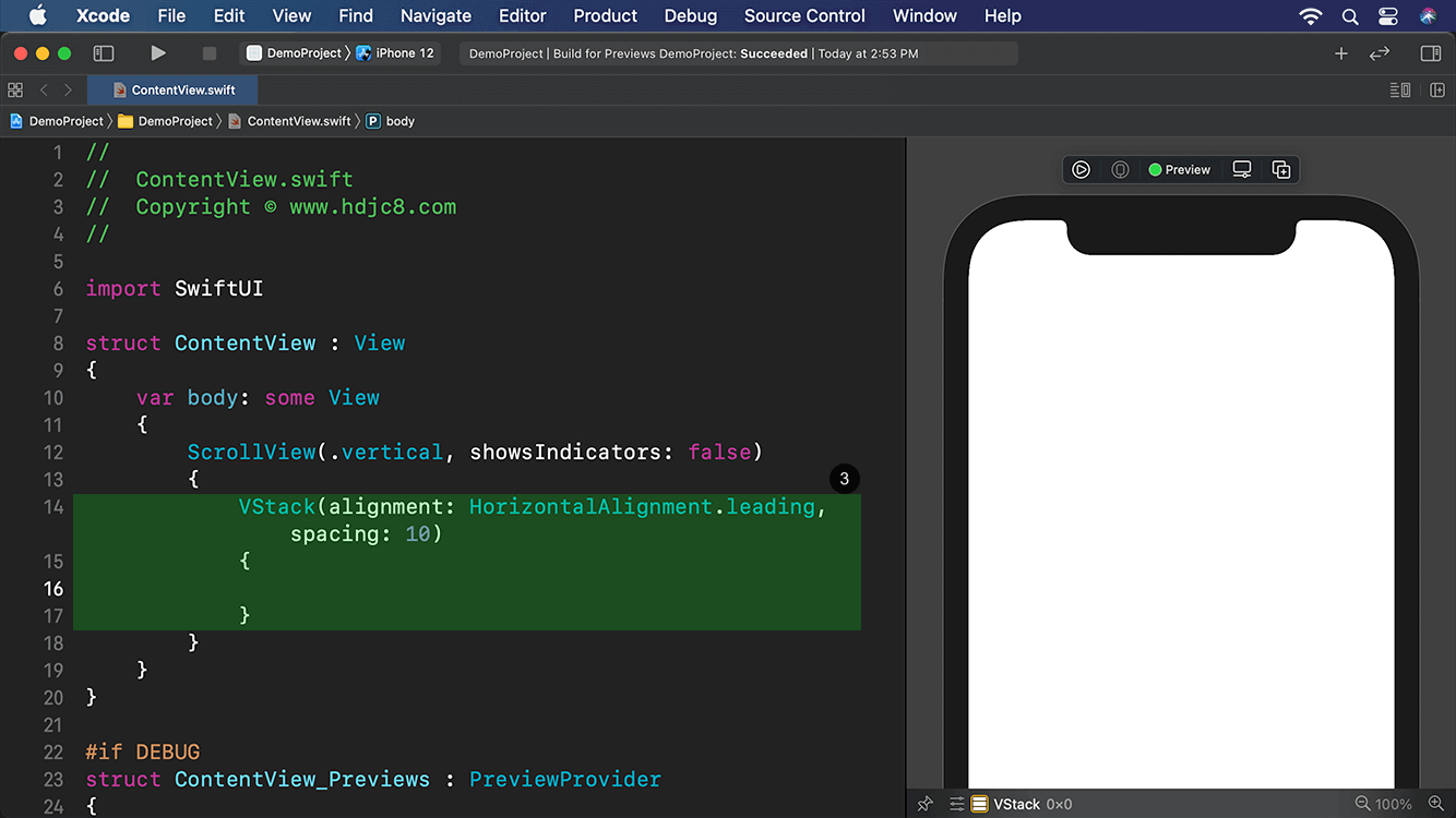 SwiftUIŵʵս