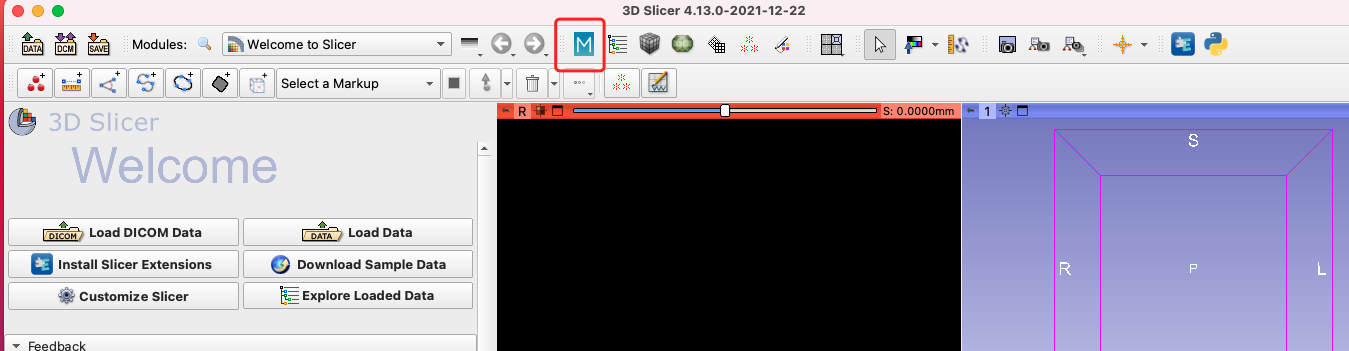 在3D slicer中使用MONAI Label 辅助标注提升标注速度-安装教程_3D_03