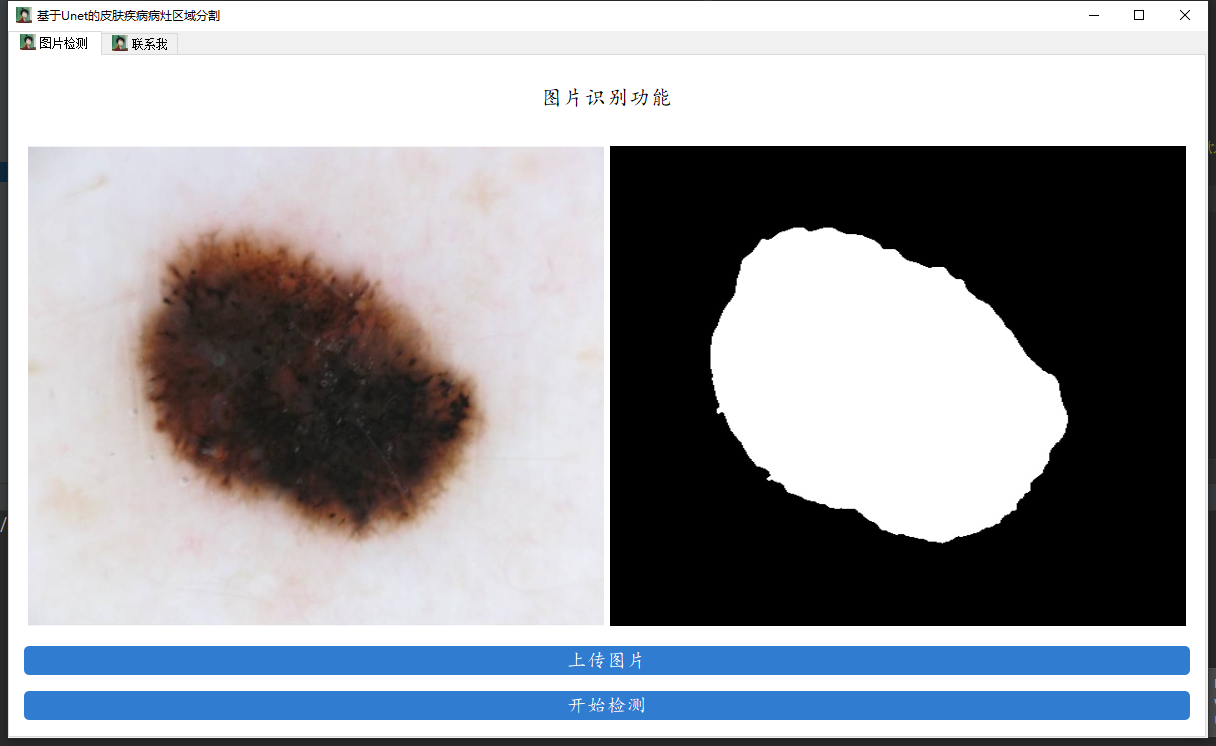 肆十二大作业系列清单_tensorflow_07