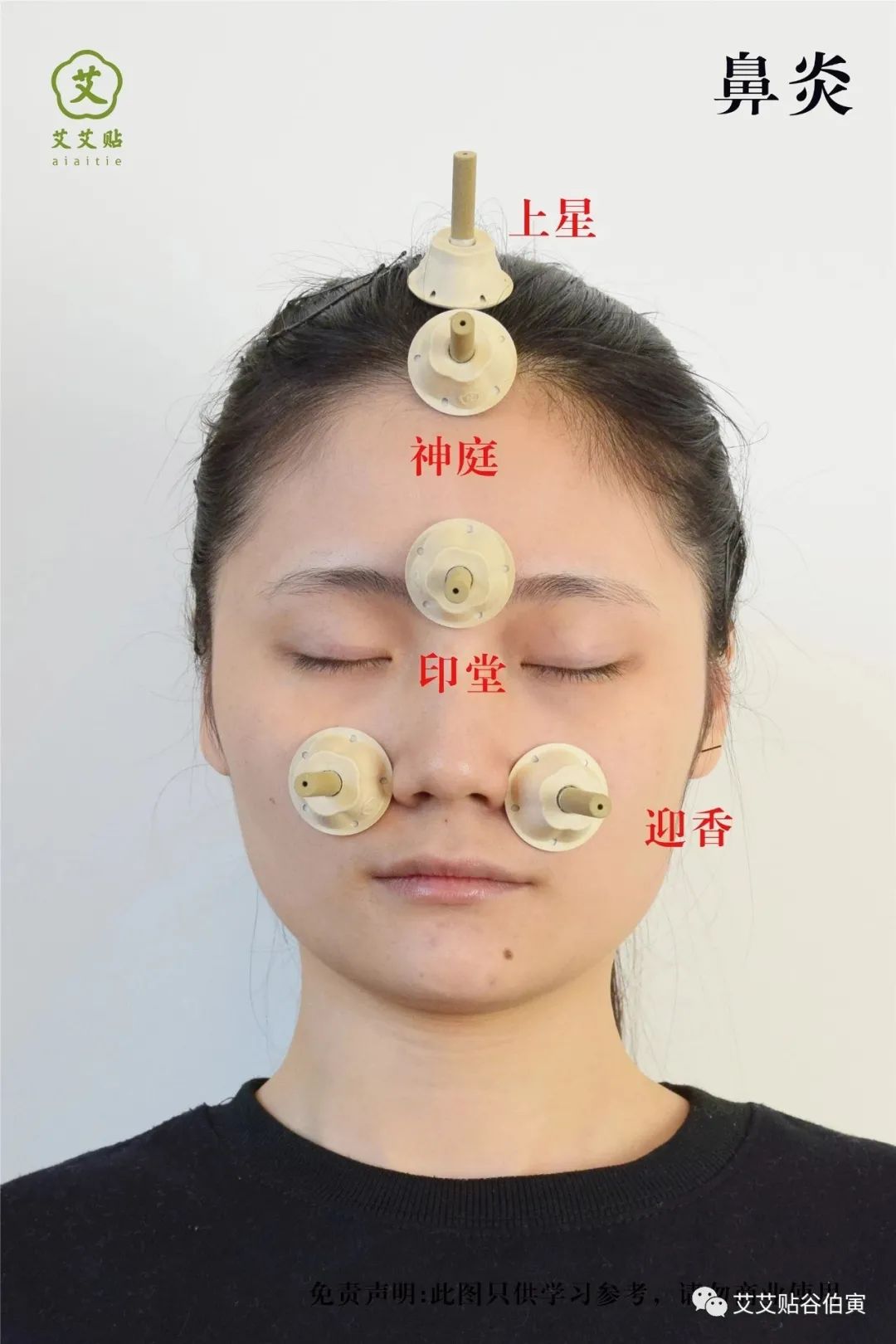 鼻子不通气艾灸位置图图片