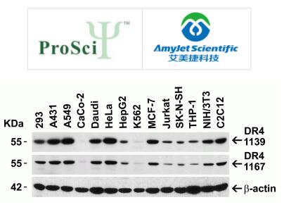 ProSci 艾美捷TRAIL和受体检测装置