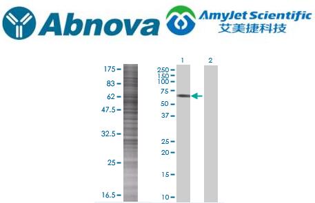 Abnova ABI2 293T 细胞瞬时过表达裂解物说明书