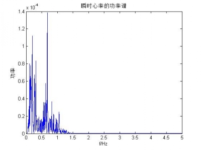 心率变异性 matlab,心率变异性好的功率谱分析方面的问题