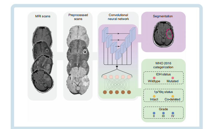 文献速递：深度学习胶质瘤诊断---结合分子亚型分析、分级与胶质瘤的多任务深度学习分割