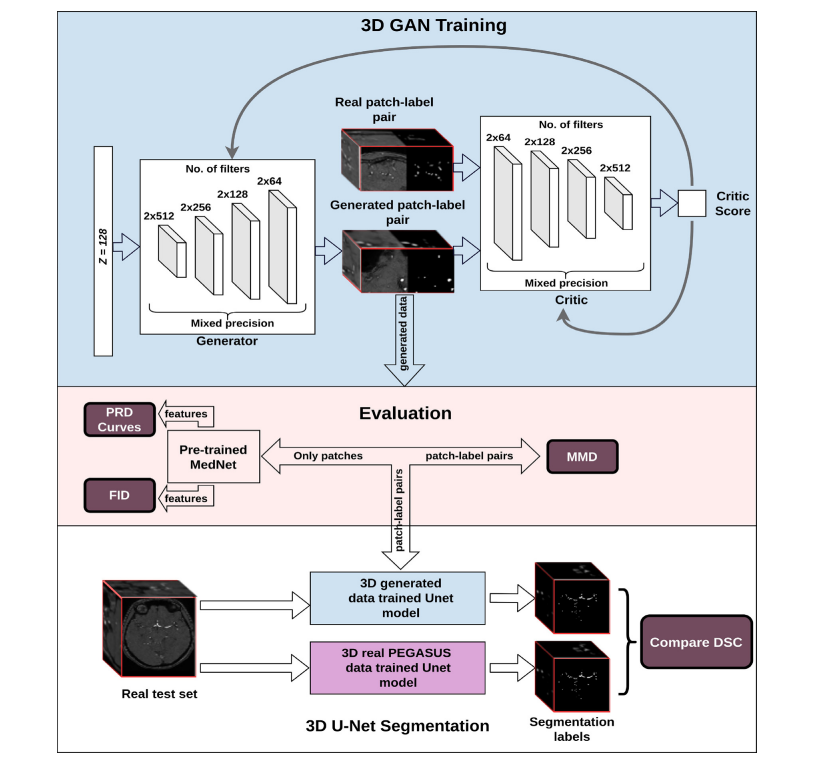 文献速递：GAN医学影像合成--用生成对抗网络生成 3D TOF-MRA 体积和分割标签