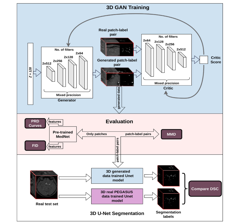 文献速递：GAN<span style='color:red;'>医学</span><span style='color:red;'>影像</span>合成--用生成对抗网络生成 <span style='color:red;'>3</span><span style='color:red;'>D</span> TOF-MRA 体积和<span style='color:red;'>分割</span>标签