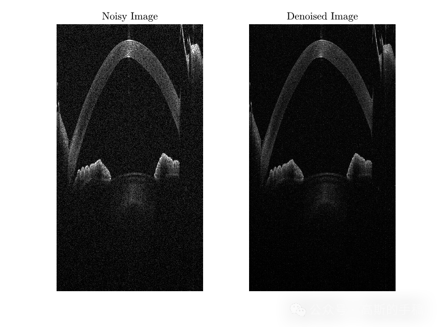 基于小波变换贝叶斯LMMSE估计的图像降噪方法（MATLAB 2018）