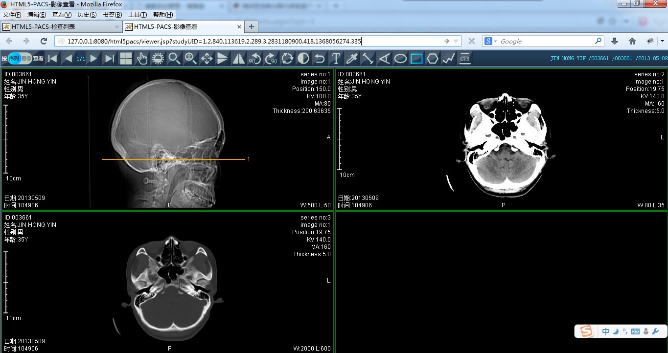 pacshtml5区域医疗移动影像解决方案–基于html5的pacs–html5图像