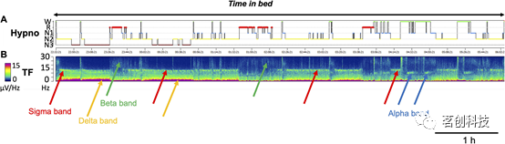 关于脑电睡眠分期，你应该知道的还有这些