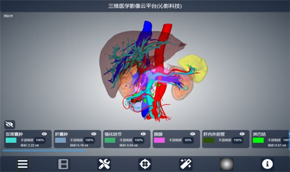 AI全息手术：未来医疗的奇迹，你准备好了吗？