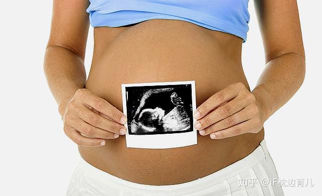 几个月做四维彩超 4f1d6faae50a4170efdab6fdc04a8756.png