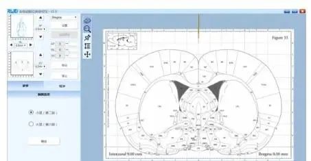 小鼠脑立体定位图谱图片