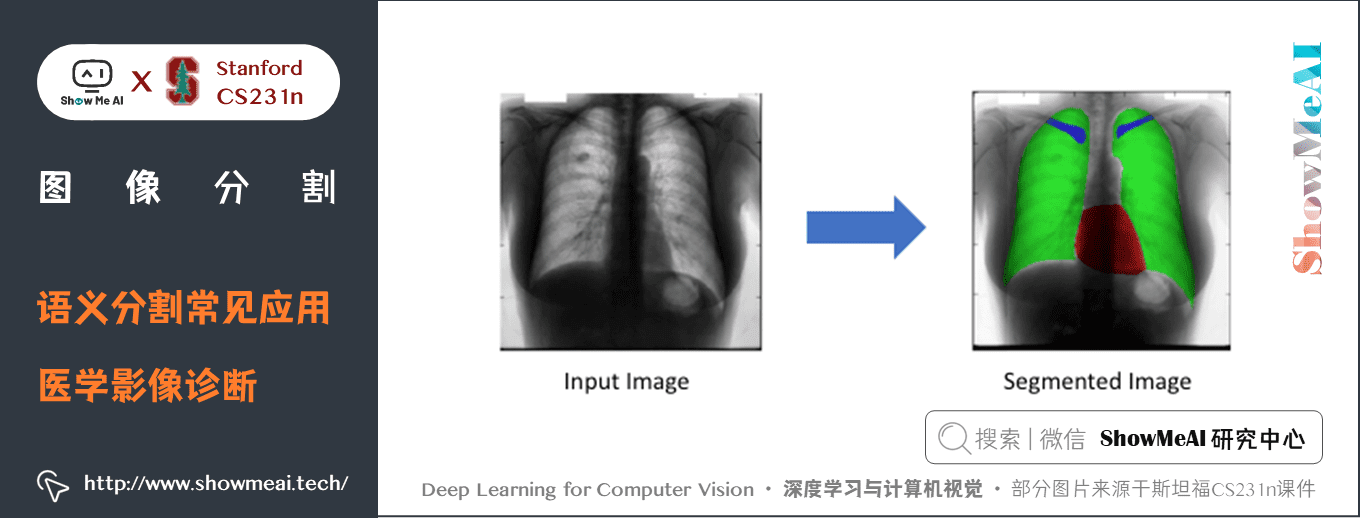 语义分割常见应用; 医学影像诊断