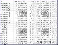 R语言对表达谱样本做PCA分析