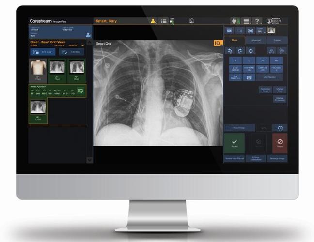 图像识别技术的应用领域 53453d460d4a6152fa0ca3fefd9c6093.jpeg