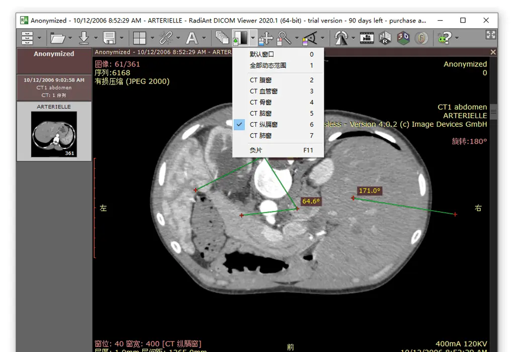 正版软件，官方授权。RadiAnt DICOM Viewer - 软件版 / CD/DVD版