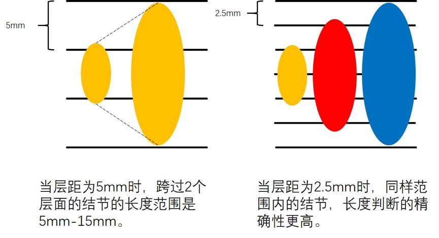 【转】肺小结节就诊指南：4种CT的区别及如何选择？