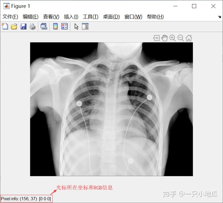 imread函数 matlab_【MATLAB图像处理学习】1.读取和显示图片