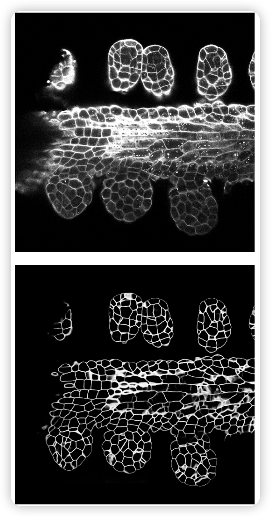 3D分割项目 | 基于Pytorch+3DUnet实现的3D体积语义分割算法