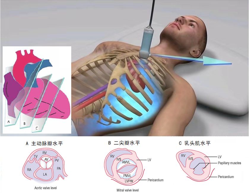 超声心动图怎么做图片