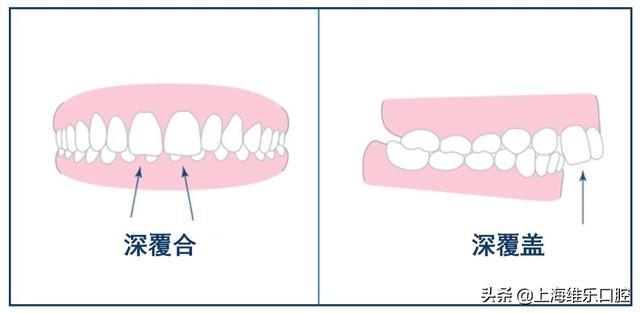638a03f91cf8709f7550590db98f2822.png