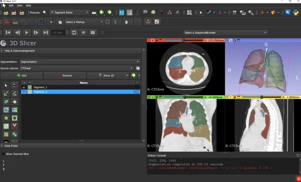 3D Slicer-最强大的开源医学图像分割工具简要概述