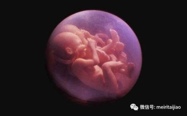 十七周胎儿图片