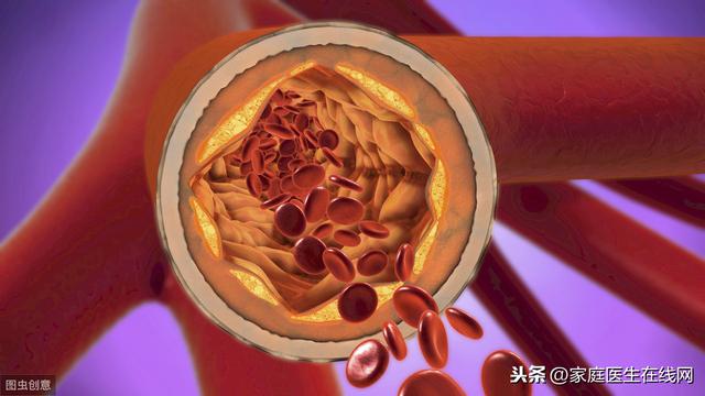 如何让鼠标跑不出来如何让血栓消失直接从血管里抽出来大多数人不适合