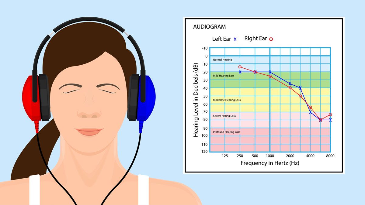 听觉动态范围是什么？