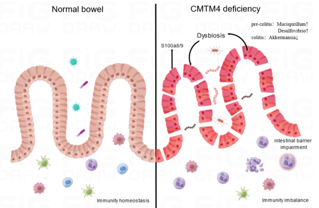 jgg丁士刚王军团队揭示膜蛋白cmtm4参与溃疡性结肠炎的新机制