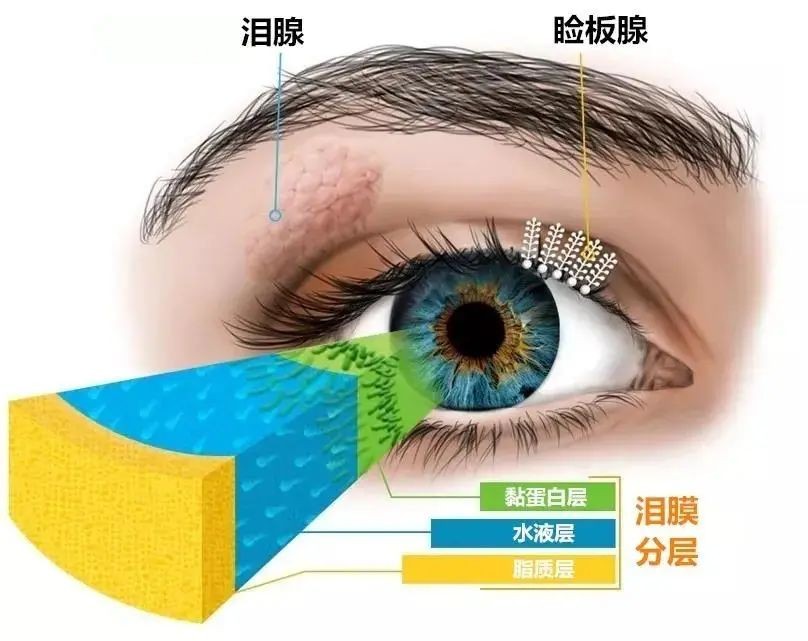 成都爱尔李晓峰主任：眼睛干到发出求救信号，快注意！