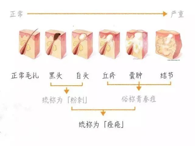 也就是说,毛孔堵塞不是因你肌肤表面脏或者空气脏,而是你新陈代谢减弱