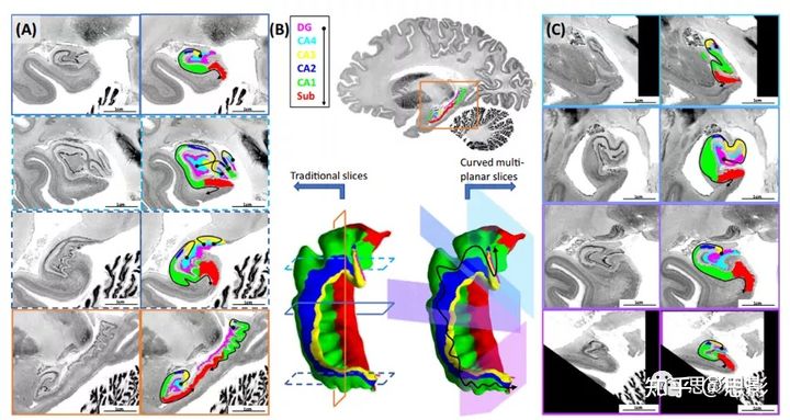 基于表面形态的海马亚区分割 思影科技的博客 Csdn博客