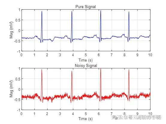 采用3种稀疏降噪模型对心电信号进行降噪（Matlab R2021B）