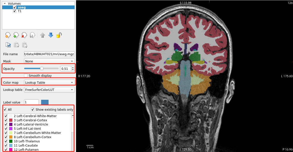 freesurfer全过程梳理-CSDN博客