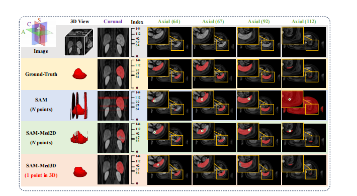 文献速递：文献速递：基于<span style='color:red;'>SAM</span>的<span style='color:red;'>医学</span>图像<span style='color:red;'>分割</span>--<span style='color:red;'>SAM</span>-<span style='color:red;'>Med</span><span style='color:red;'>3</span><span style='color:red;'>D</span>