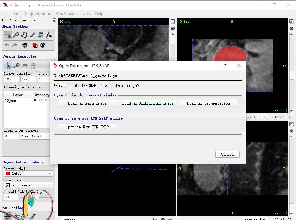 ITKSNAP基础教程_itk snapCSDN博客