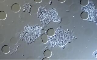 显微镜下活蹦乱跳的 中性粒细胞