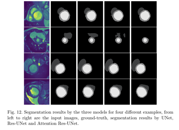 医学图像分割：Performance Analysis of UNet and Variants for Medical Image Segmentation