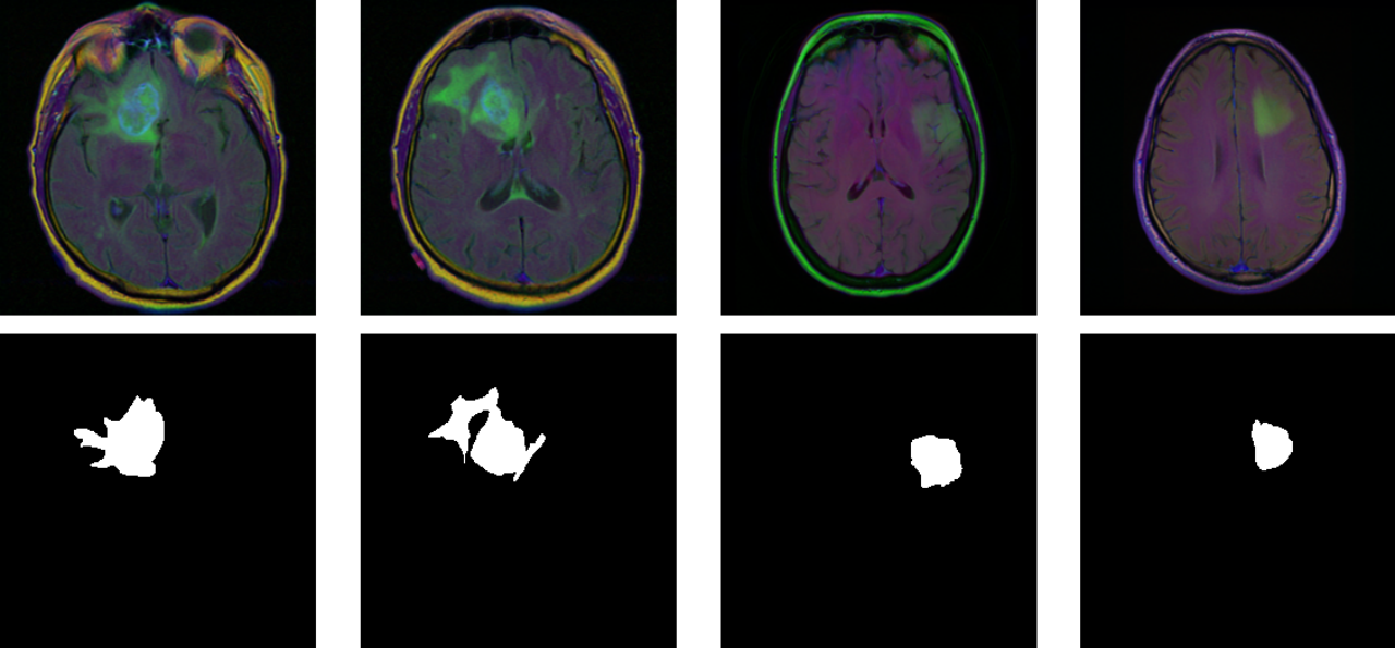 【深度学习】实验4布置：脑部 MRI 图像分割