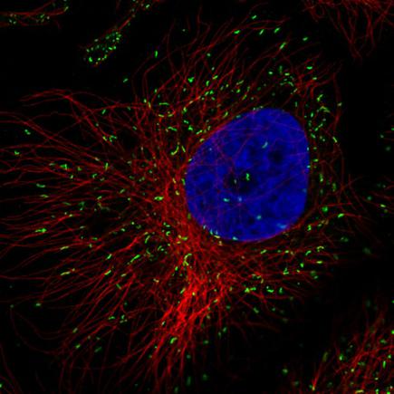 Anti-ABCD3 Antibody-Monoclonal Antibody against Human ABCD3