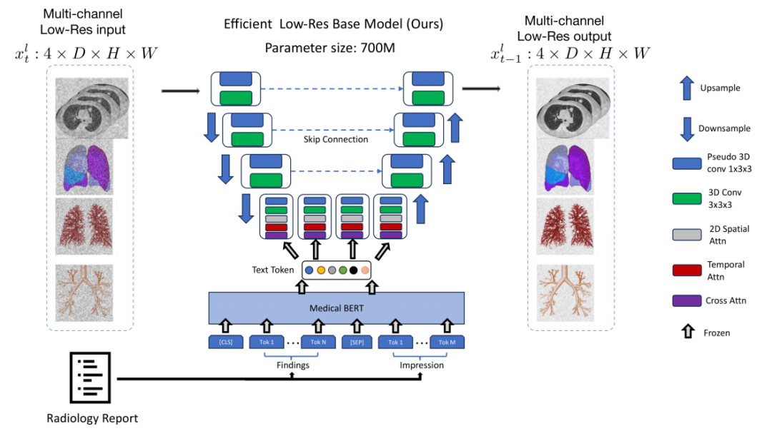 医学生成模型medsyn 文字引导,ai 画 出高保真ct图像