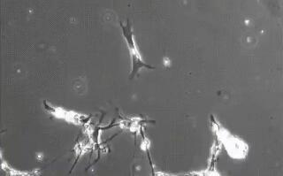 显微镜下的神经元