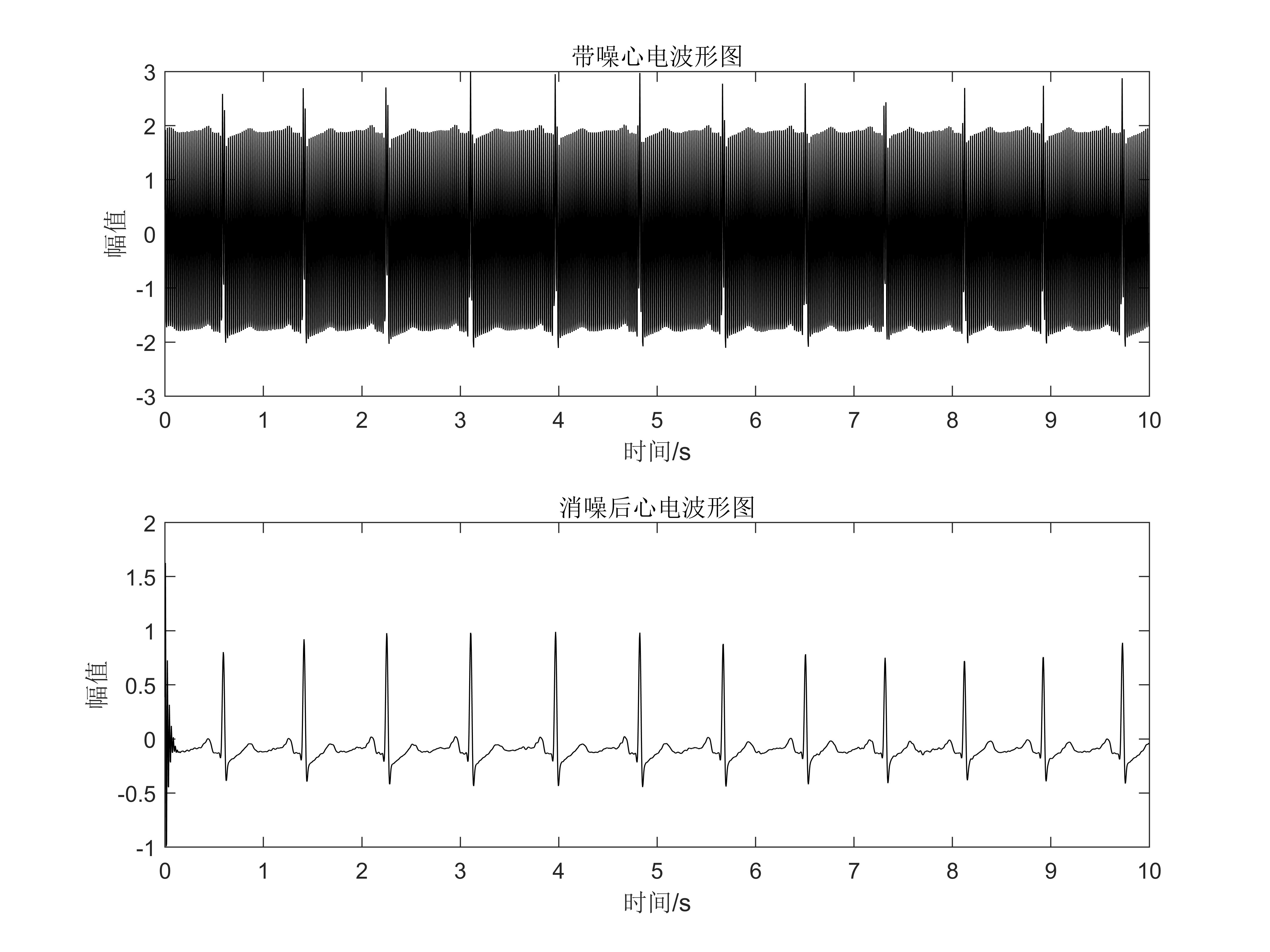 【MATLAB】数字滤波器的设计