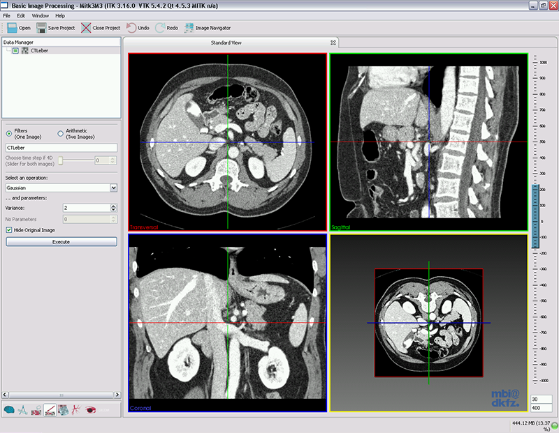 QmitkBasicImageProcessing_BIP_Overview.png