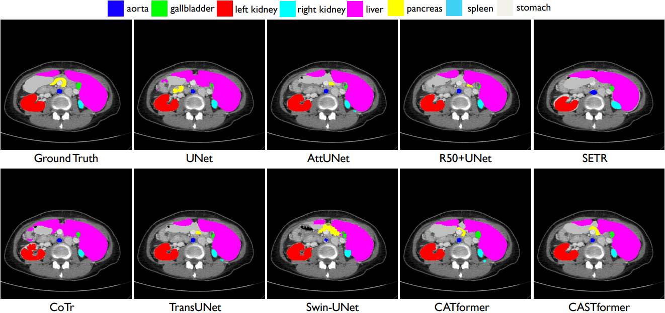 Visual comparisons with other methods on Synapse dataset